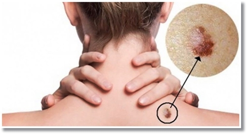 os-sintomas-de-IST.jpg os-sintomas-de-IST.jpg