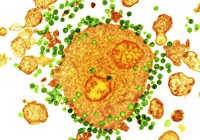 A colored transmission electron micrograph of the H.I.V. virus, in green, attaching to a white blood cell, in orange.CreditCreditNIBSC/Science Source