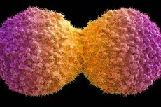 A UFPB busca parceria com empresas farmacêuticas ou de biotecnologia para a realização de experimentos do composto A398 em seres humanos. Na imagem, a reprodução de células cancerígenas. Foto: Maurizio de Angelis/Science photo library/Getty Images